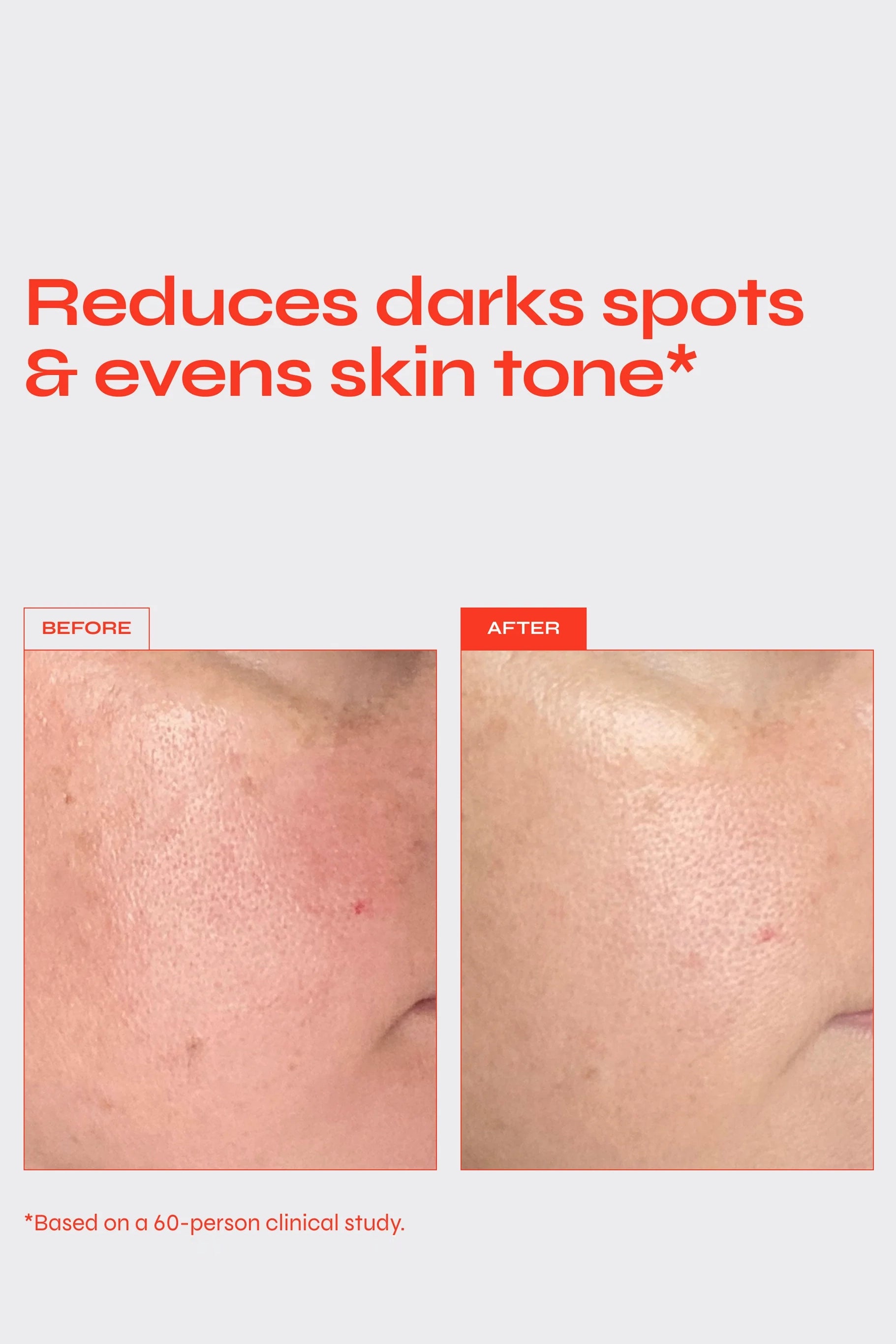 BRIGHTEN - Targeted Pigment Serum Accessories Facile